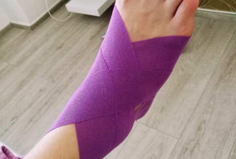 Kineziotaping